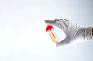 What Is Ureaplasma Urealyticum